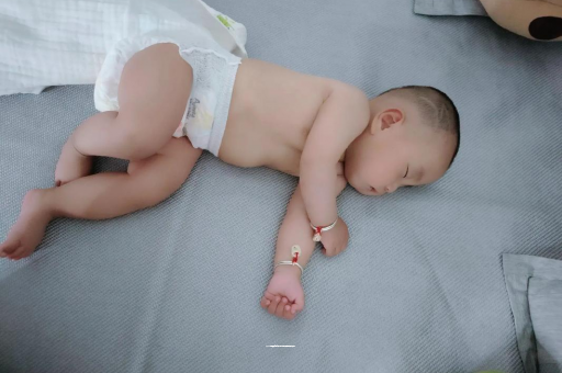 昆明宝宝头上长痱子